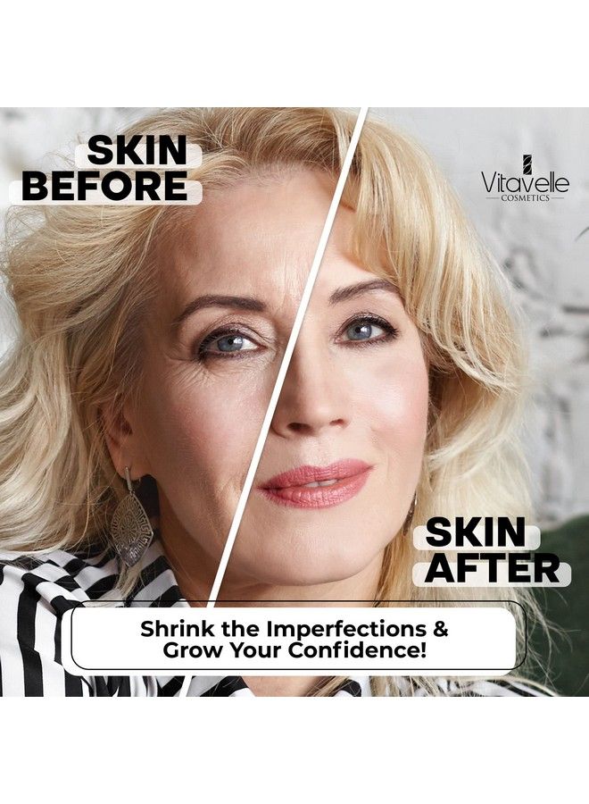 Niacinamide Cream Daily Niacinamide Moisturizer For Face Strengthening Pore Reducer For Face With Plantderived Retinol Shea Butter & Niacinamide Serum For A Smooth & Even Complexion