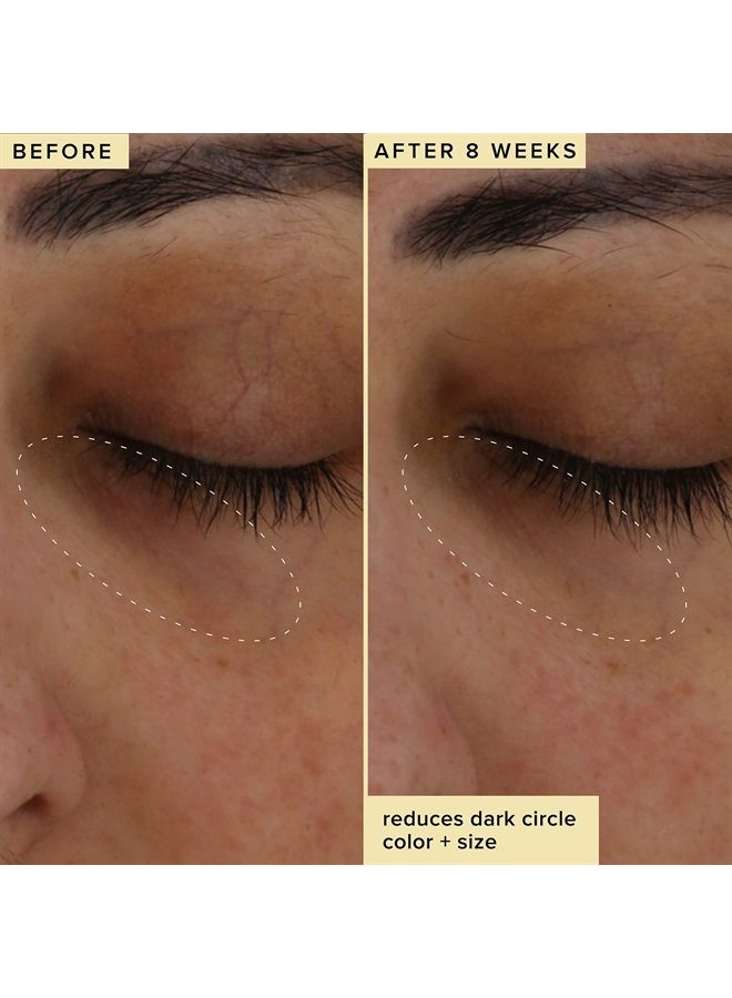 Wake Up Honey Eye Cream for Dark Circles and Puffiness - Under Eye Cream for Wrinkles and Bags Under Eyes - Formulated with Caffeine & Vitamin C