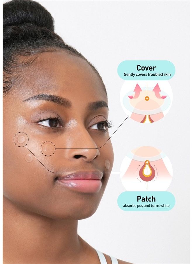 Care Plus Spot Patch 1 Pack | Hydrocolloid Acne Korean Spot Patch to Cover Zits, Pimples and Blemishes, for Troubled Skin and Face (102 Count - 10mm*72ea + 12mm*30ea)