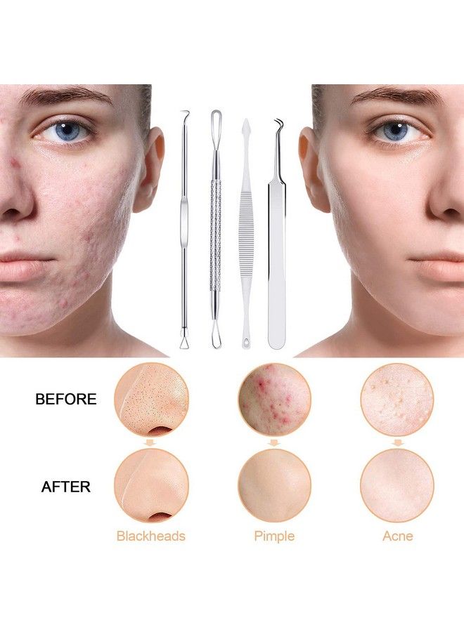 Pimple Popper Tool Kit 10 Pcs Blackhead Remover Zit Popper Tools For Blemish Pimple Comedone Extractor Acne Tool For Nose Face With A Leather Bag