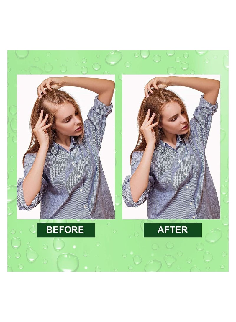 Rosemary Essential Hair Growth Oil Pure Organic Rosemary Oil for Dry Damaged Hair, Hair Growth Scalp Oil 2.02 Fl Oz