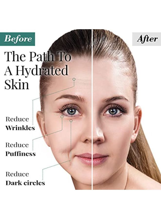 D Under Eye And Forehead Patches - 26 Pcs - Collagen And Hyaluronic Acid Pads That Helps Reducing Under Eye Puffiness, Wrinkles, And Dark Circles - No Artificial Fragrance Or Alcohol
