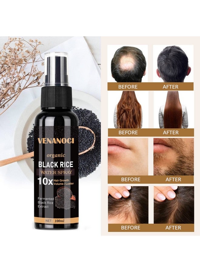 Enanoci Hair Growth Serum Rice Water Spray For Hair Growth For Women & Men Treatment For Hair Loss Damaged Dry Hair Hair Regrowth For Thicker Longer Fuller Hair With Castor Oil Ginger