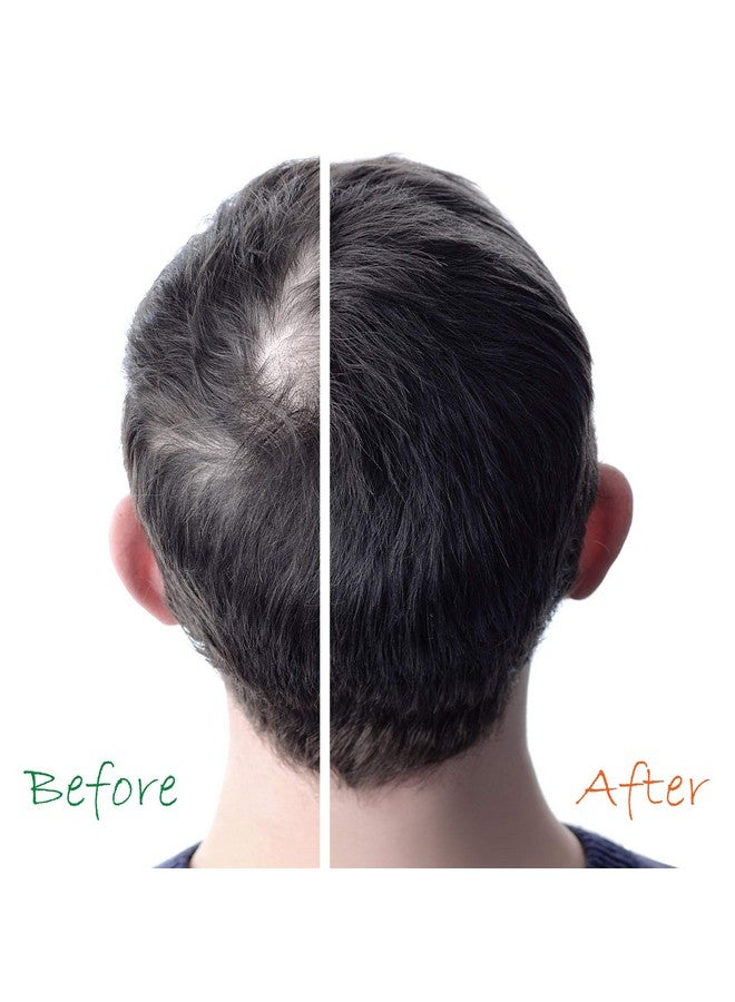 Original Hair Energizer Growth Shampoo & Conditioner 2 In 1 Set 13 Fl Oz Each Dht Blocker + Ph Balancer Duo Pro Vitaminb5 Sulfatefree Stop Loss & Thinning At Root Regrow Treatment For Male & Female