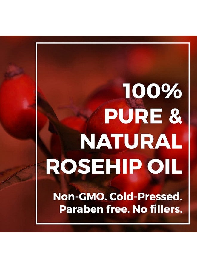 Even Rose Rosehip Oil Bulk Wholesale 32 Oz 100% Natural Organic Rosehip Seed Oil Bulk