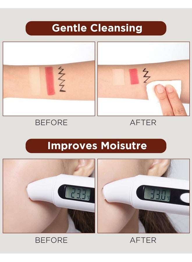 Licorice Ph Balancing Korean Toner For Cleansing 5.07 Fl.Oz. Ph5.5 Hydrating Makeup Cleansing Astringent Skin Clearing Reduce Pigmentation Acne And Dark Spots