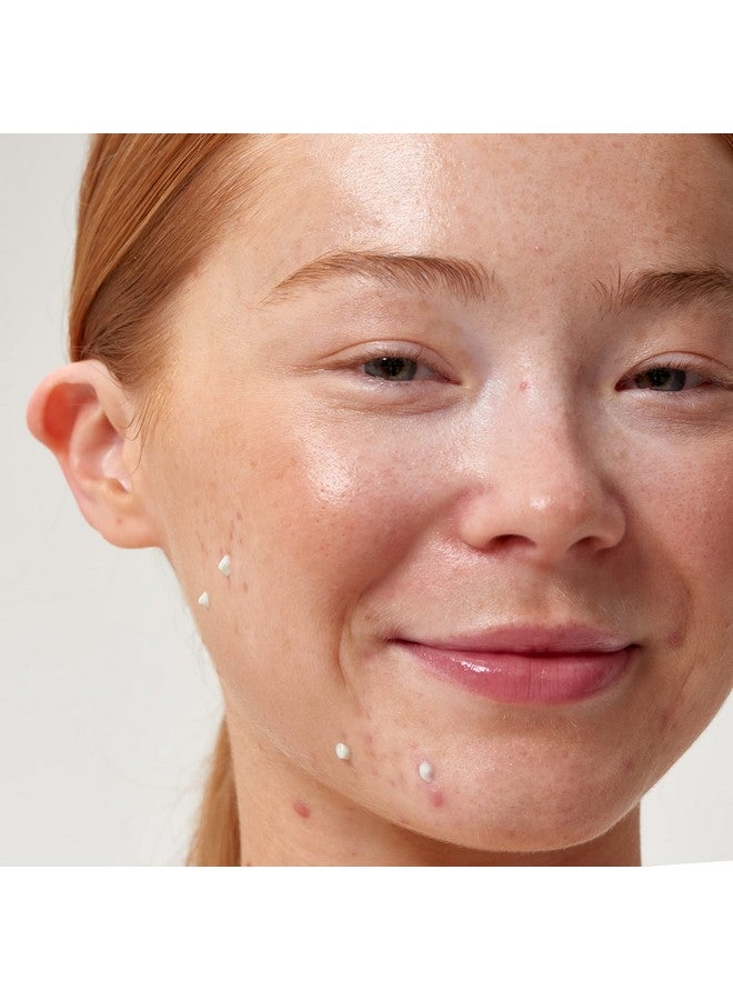 Succinic Acid Acne Treatment Reduce Blemishes And Clear Clogged Pores 1% Salicylic Acid .50 Fl Oz