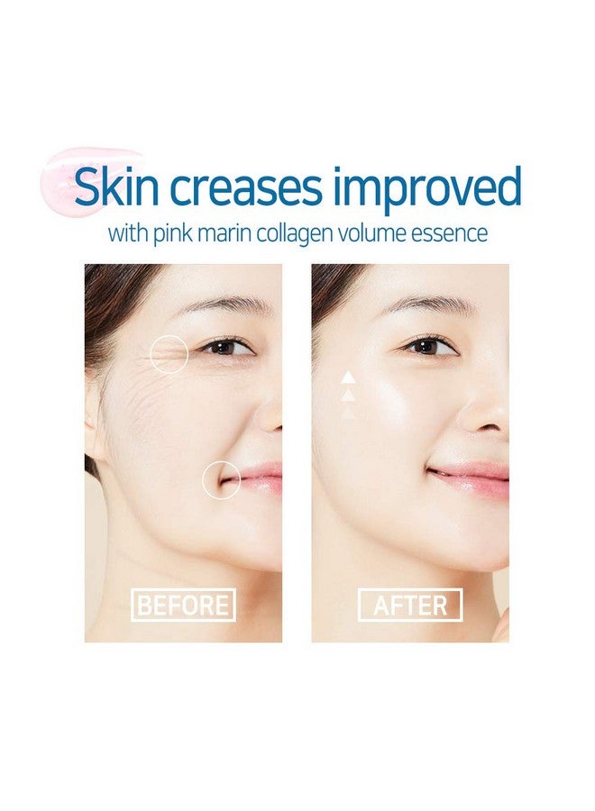 Marine Collagen Ample Collagen Serum/Functionality For Improvement Of Wrinkles And Contains Marine Collagen Extracts/Collagen Essence/Water Serum Before And After