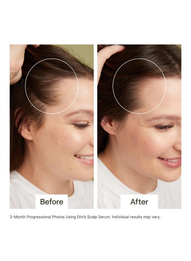 Scalp Serum Revitalize And Detoxify Aids Against Hairthinning Nourishes Hair Follicles Detoxifies Product Buildup (30 Ml)