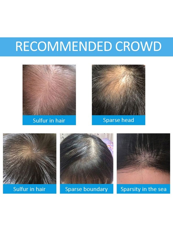 Hair Building Fibers For Thinning Hair With Spray Applicator Pump Nozzle Natural & Undetectable Instantly Thicker Fuller Hair Conceals Hair Loss 30 Sec 4 Shades For Men & Women 27.5G (Black)