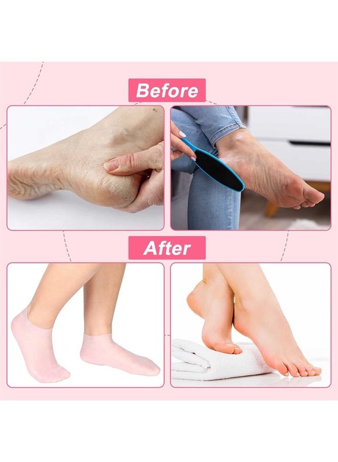 Silicone Socks 3 Pairs Aloe Socks Silicone Gel Heel Socks Anti Slip Silicone Moisturizing Socks for Women Men Dry Cracking Skin (Medium), Pink, Beige and White,Medium