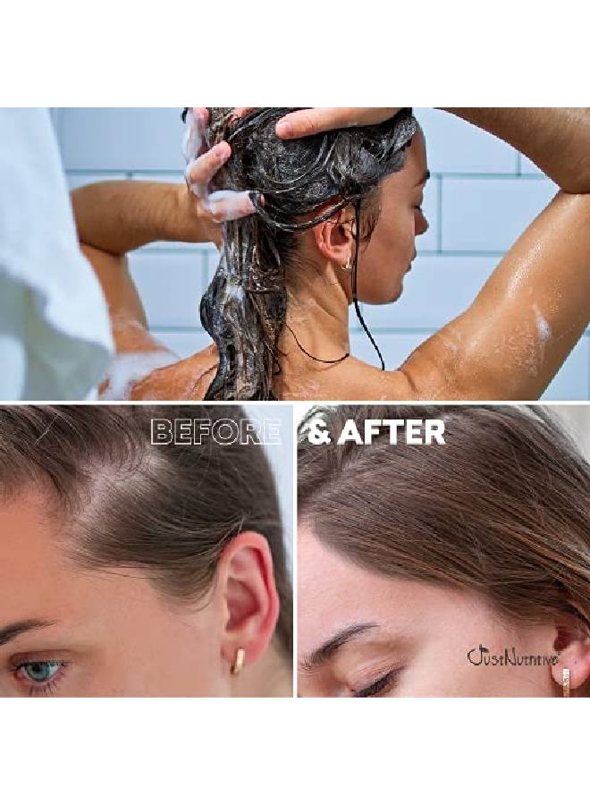 Hair Loss Shampoo ; Hair Regrowth Shampoo For Thinning Hair ; Hair Growth Product For Men And Women ; ; 16 Oz