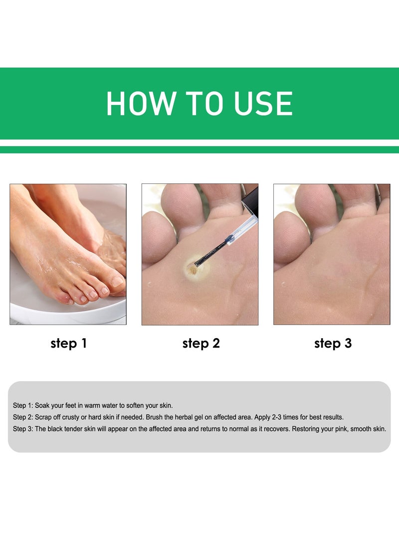 Jaysuing Wart Removing Corns Eye Liquid Smoothes Skin Gentle Foot Care Solution