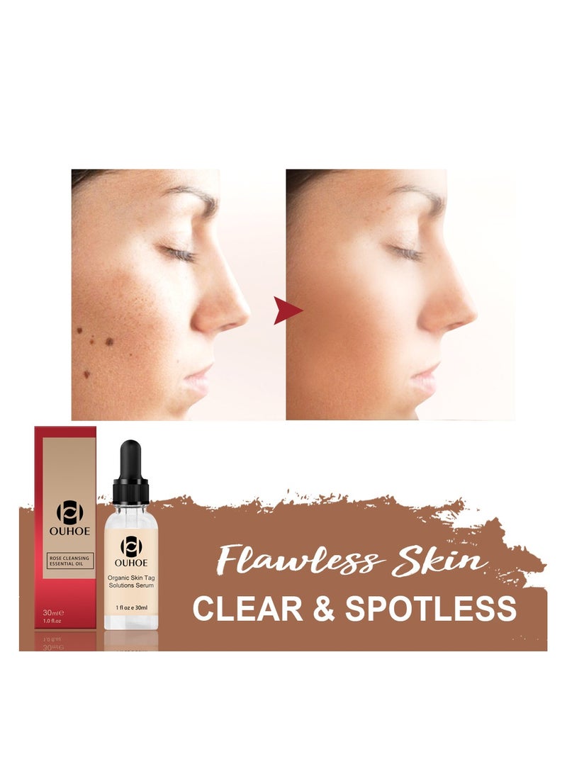 Mole Elimination Cream Repair and Remove Black Spots Rose Essential Oil Moisturizing Skin Care Solution