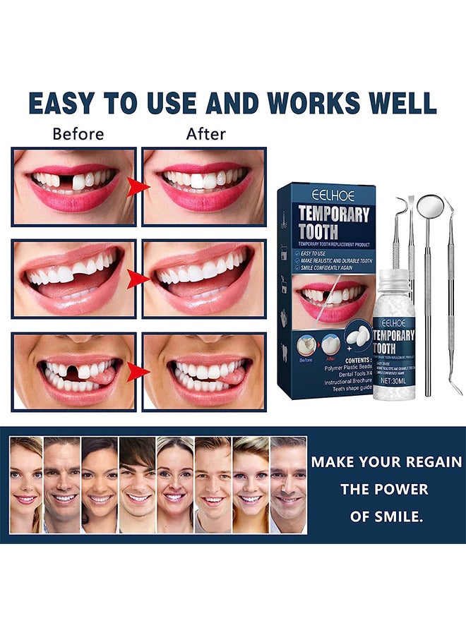 Temporary Teeth Repair Kit, Tooth Repair Kit For Missing Teeth, Cavity Filler For Teeth, Temp Tooth Beads With 4 Dental Tools, Repair Missing Or Broken Teeth, Snap On Instant And Confident Smile