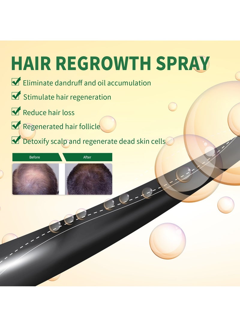 Hair Growth Spray Thickening Preventing Hair Loss Hair Care Spray