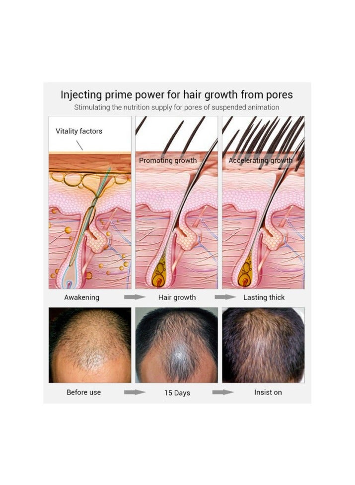 Lanbena Hair Growth Essential Spray 20ML