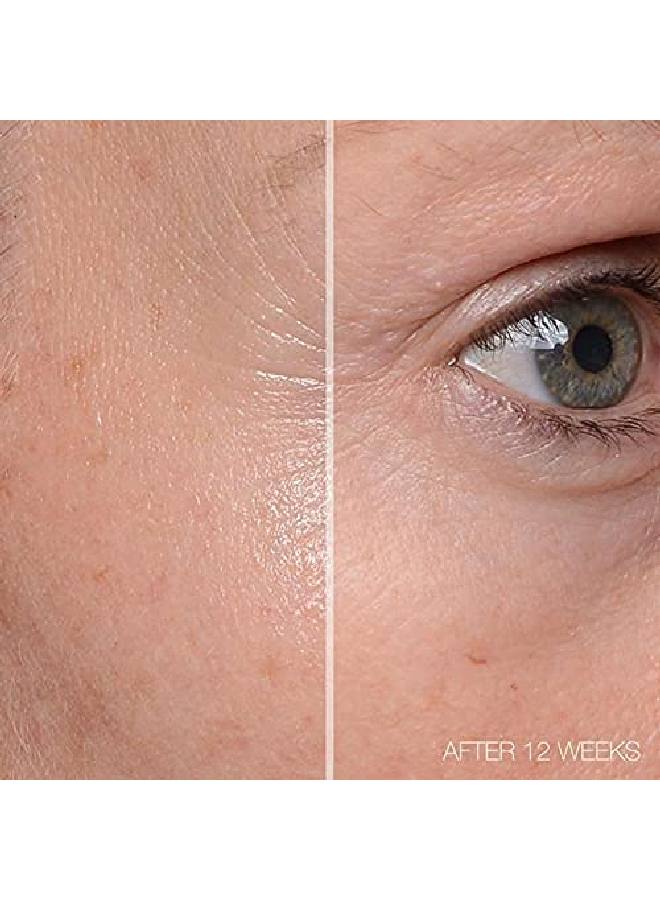 Md Complete Total Eye Treatment ; Antiaging Hydrating Skin Renewal Eye Treatment ; With Peptides, Vitamins C & E And Hyaluronic Acid For Wrinkles, Fine Lines And Crows Feet 0.5 Fl Oz