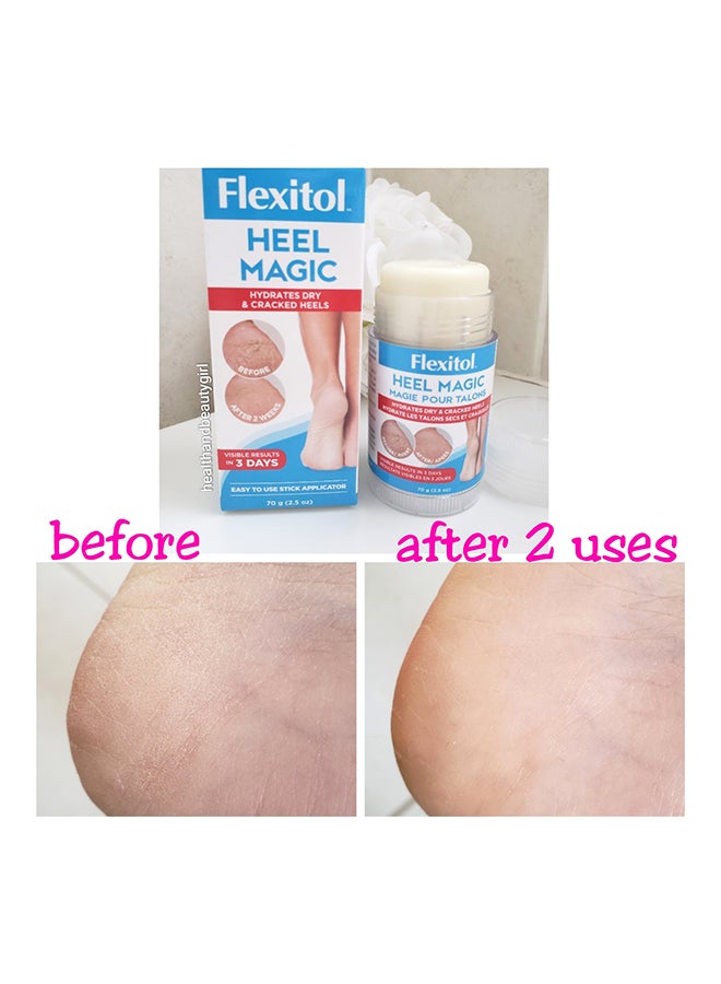 Heel Magic 70grams