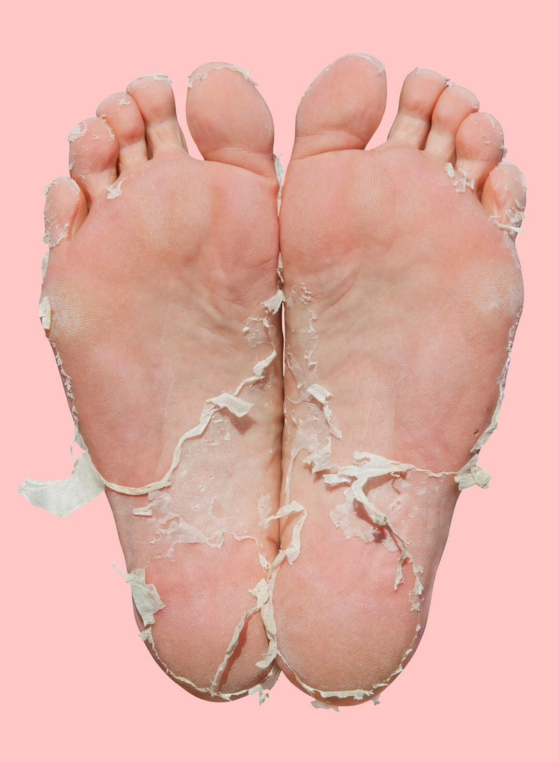 Pedi Peel Foot Mask (10 Pairs) – Exfoliating Foot Mask with AHA, Tannic Acid & Ginkgo Biloba, Removes Hard Skin, Cracked Heels & Calluses in 7 Days, Fights Odour, Smooths & Repairs Skin