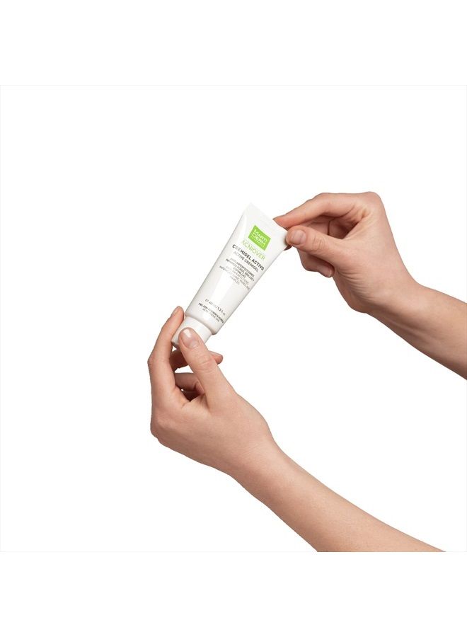 Acniover Cream-gel 40ml