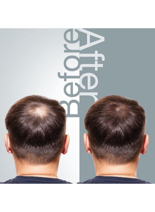 Hair Loss Shampoo For Thinning Hair ; Hair Growth Shampoo For All Hair Types 6.7 Fl Oz (200Ml)