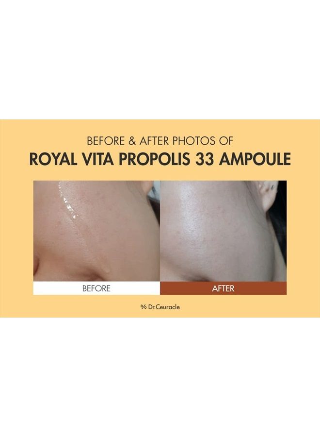 [Dr.Ceuracle] Honey Nourishing Anti-Aging EssenceㅣRoyal Vita Propolis 33 AmpouleㅣKorean Skin Care with Royal Jelly Extract, PanthenolㅣEffective Vitamin Serum strengthen Moisturizing, Soothing