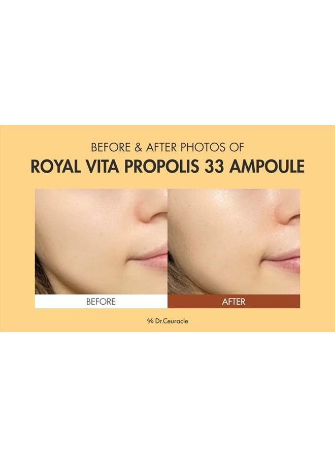 [Dr.Ceuracle] Honey Nourishing Anti-Aging EssenceㅣRoyal Vita Propolis 33 AmpouleㅣKorean Skin Care with Royal Jelly Extract, PanthenolㅣEffective Vitamin Serum strengthen Moisturizing, Soothing