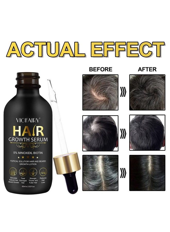 Hair Growth Oil Biotin Hair Growth Serum 5% Minoxidil Hair Growth Treatment For Men & Women Hair Growth Serum For Thicker Longer Fuller Healthier Hair Stop Thinning & Hair Loss