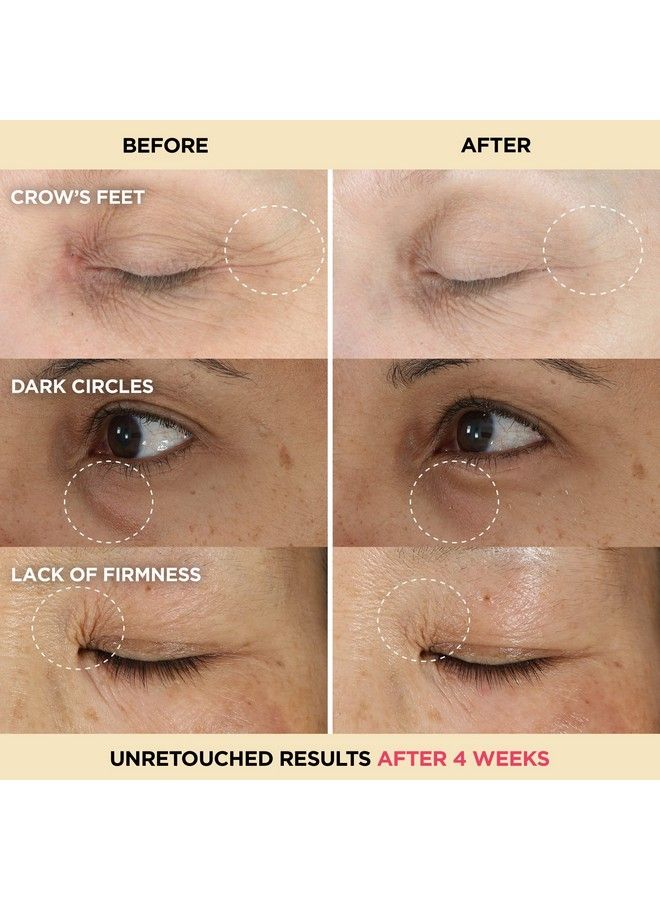 Confidence In An Eye Cream Anti Aging Eye Cream For Dark Circles Crow
