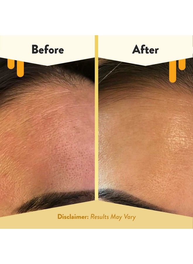 Concentrated Nighttime Renewal Face Cream Anti Aging Skin Care Products Face Moisturizer For Eczema Dry & Sensitive Skin