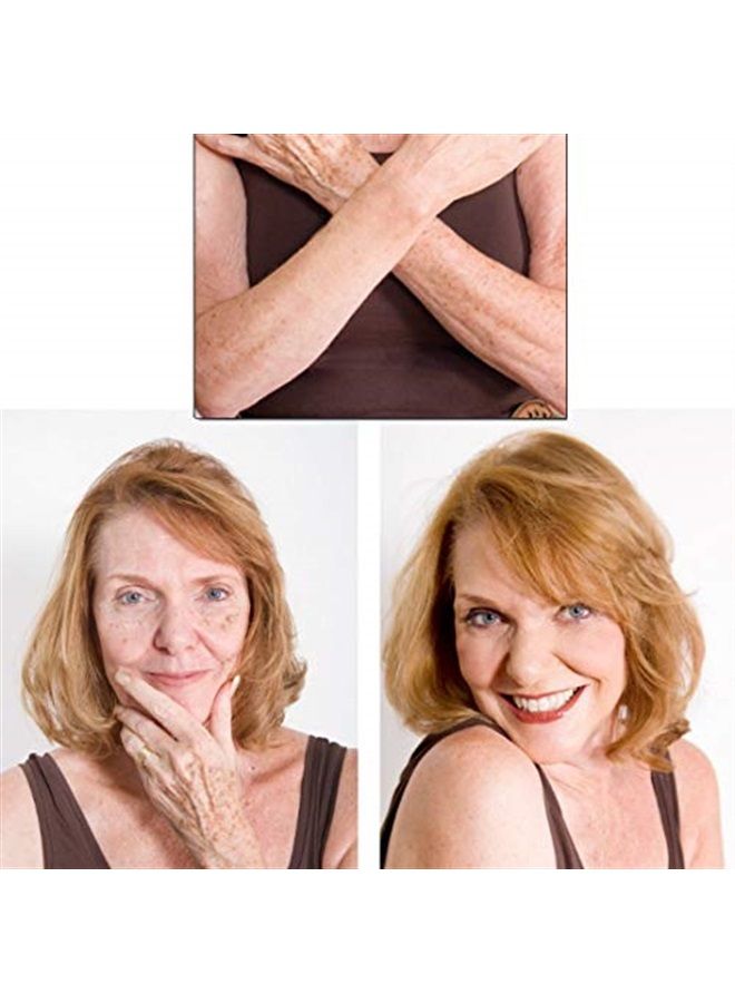 Killer Cover Concealer - Classic - Cover Bruises, Tattoos, Age Spots, Vitiligo & More