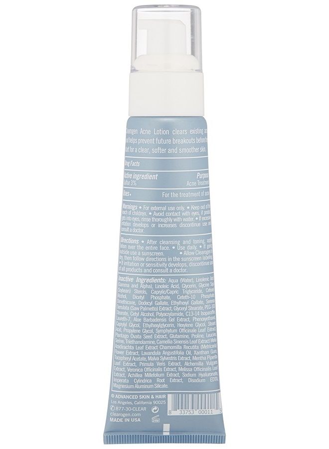 Sensitive Skin Sulfur Acne Lotion for acne and blemishes, Natural Anti-DHT Ingredients, Fresh Botanical, Clears current acne and prevents future breakouts, 1.8 Fl Oz