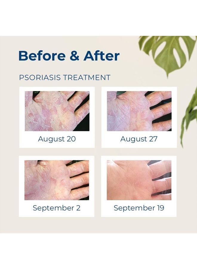 Shielding Lotion - GREAT for Dry Itchy Skin! Grease-less and Scent FREE! (2oz-60ml)