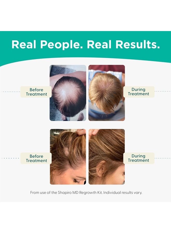 Hair Loss Shampoo and Conditioner | DHT Fighting Vegan Formula for Thinning Hair Developed by Dermatologists | Experience Healthier, Fuller & Thicker Looking Hair – Shapiro MD | 1-Month Supply