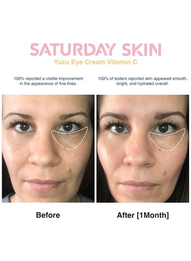 Yuzu Eye Cream Vitamin C Wide Illuminating Under Tight Eye Cream Korean Niacinamide Caffeine for Wrinkles, Puffy Eyes, Dark Circles, Moisturizing, Hydrates, Anti Aging for Women (15ml)