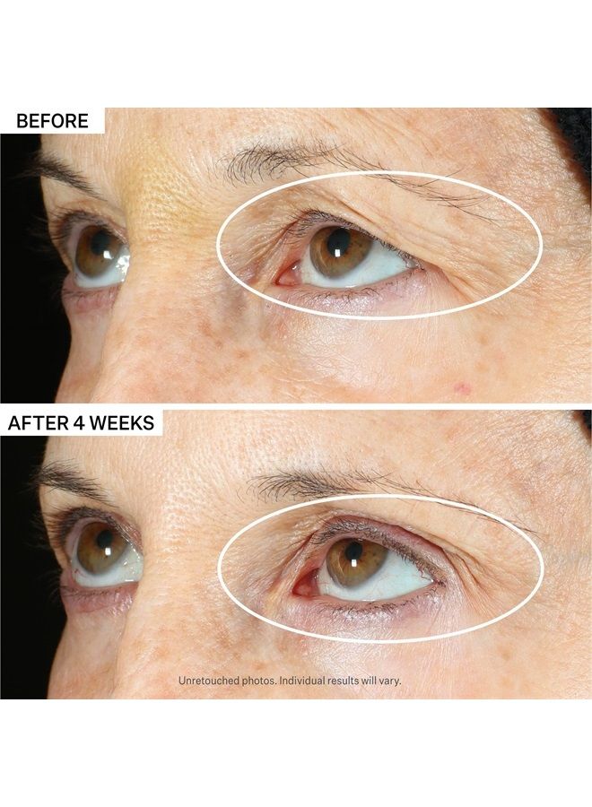 Tighten & Lift Peptight 360 Degree Eye Serum with Tightening & Brightening Peptides for Wrinkles, Under Eye Bags and Puffiness, 1 fl. Oz