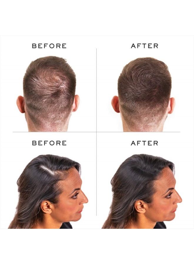 Hair Thickening Keratin Fibres Light Brown