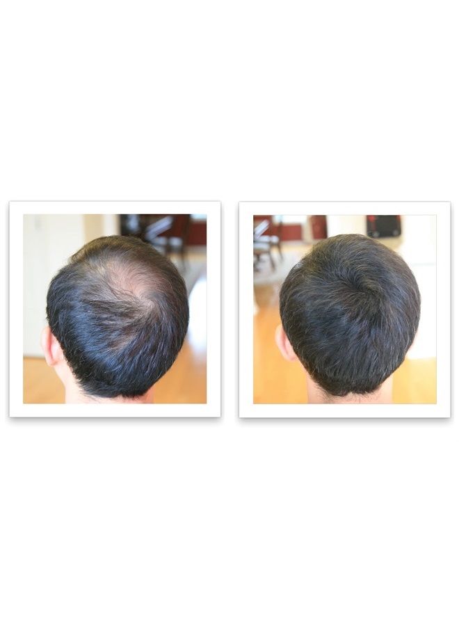 Hair Loss Concealer, All-Natural Hair Building Fiber. Make Thin Hair Look 10X Fuller Instantly. Eliminate the Appearance of Bald Spot and Thinning Hair (30G, 90-Day Supply). Black