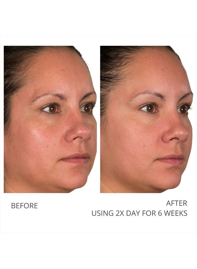 A Defiance Retinol Pads – Daily Facial Treatment - Vitamin A - Pre-Soaked Facial Pads - Micro Exfoliate Dead Skin Cells – Sugar Cane Extract – Algae Extract -120 Pads (2Pack/60 Pads E