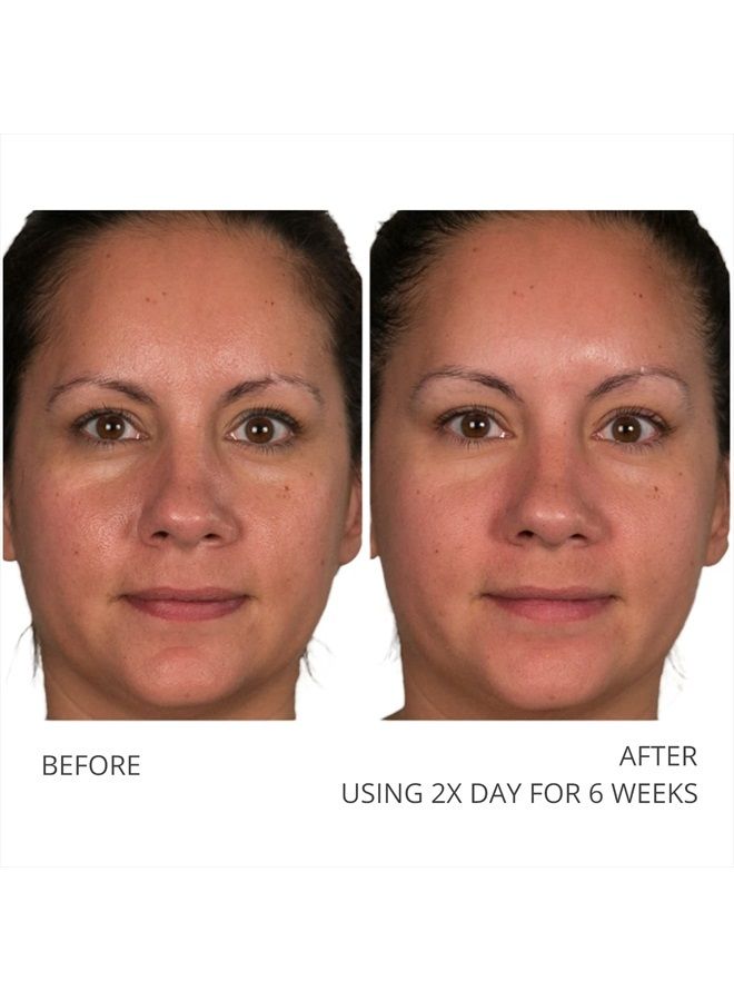 A Defiance Retinol Pads – Daily Facial Treatment - Vitamin A - Pre-Soaked Facial Pads - Micro Exfoliate Dead Skin Cells – Sugar Cane Extract – Algae Extract -120 Pads (2Pack/60 Pads E