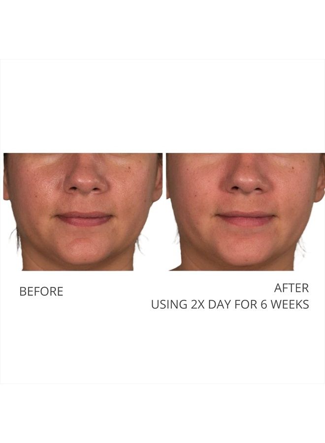 A Defiance Retinol Pads – Daily Facial Treatment - Vitamin A - Pre-Soaked Facial Pads - Micro Exfoliate Dead Skin Cells – Sugar Cane Extract – Algae Extract -120 Pads (2Pack/60 Pads E