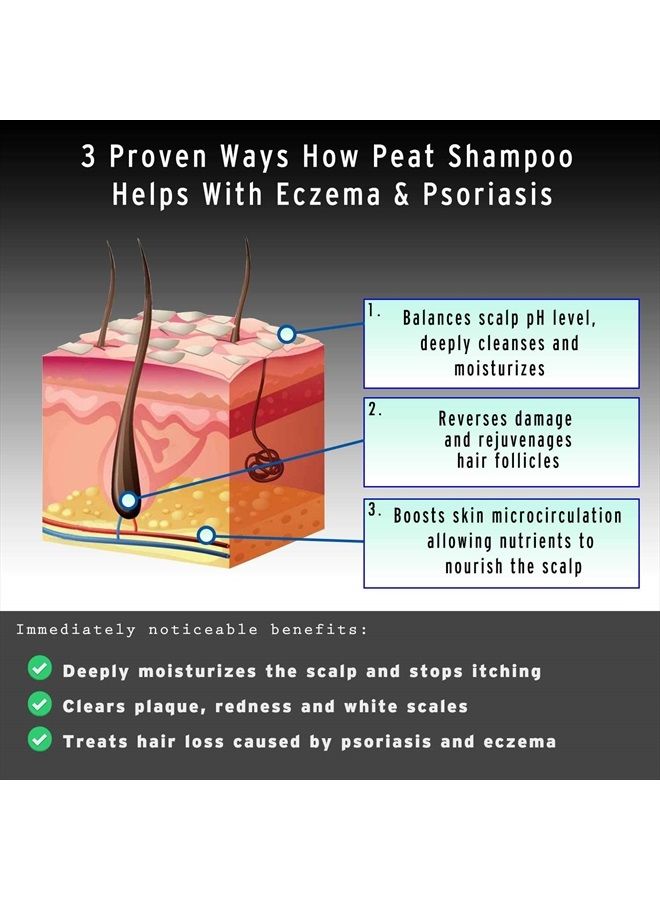 Psoriasis Shampoo and Conditioner Set - Peat Mud Therapy for Itchy Scalp with Argan and Olive Oil Treatment, No Coal Tar. For Both Men and Women. 2 x 8.45 fl. Oz