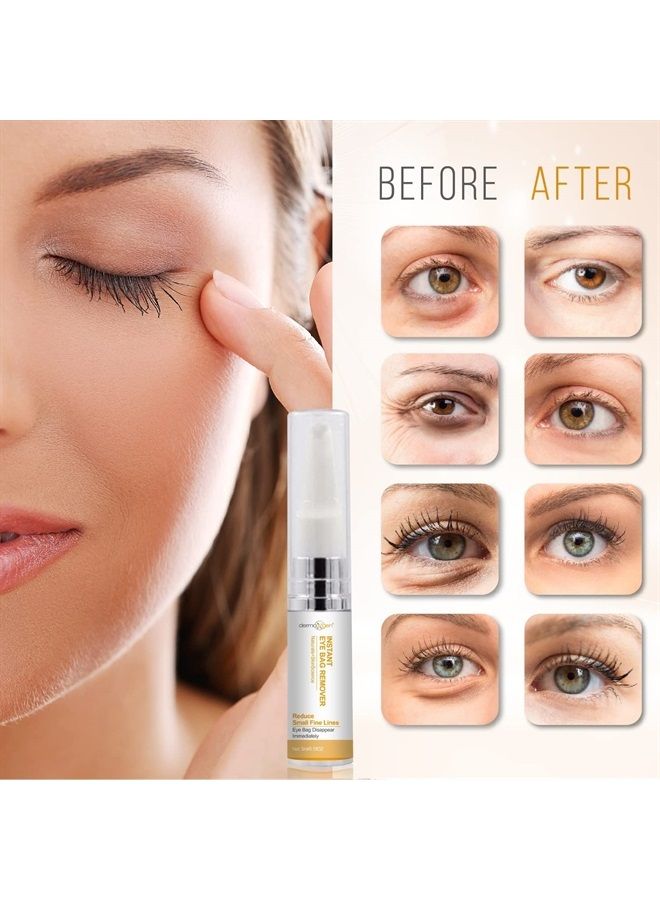 Dermaxgen Instant Eyebag Remover Anti Aging Reduce Dark Circles, Puffiness, Under Eye Bags, Wrinkles & Fine Lines For Men & Women