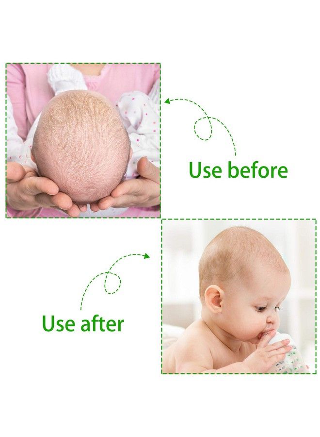 2 Pieces Cradle Cap Brush And Comb 3In1 Design Cradle Cap Brush Safe Baby Scalp Brush With Soft Rubber Bristles Help Gently Massage Care Scalp (Green)