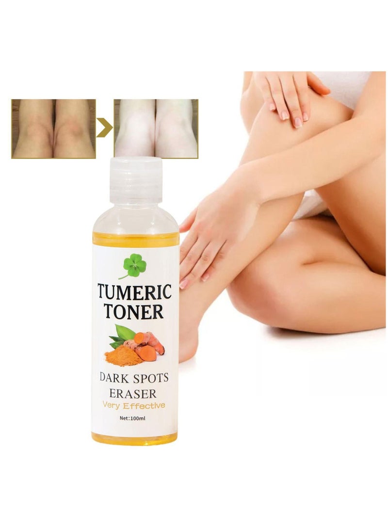 Turmeric Dark Spot Corrector Toner 100ml Facial Toner for Acne Prone Skin Dark Spot Remover for Face Hydrating Face Toner for Women Treatment for Dry Oily Skin