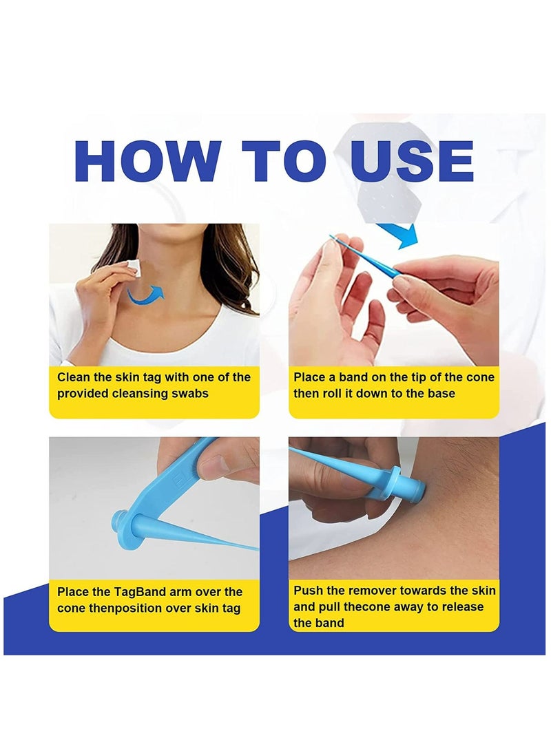 Skin Tag Removal Kit 2in1 Safe for Most Body Parts Painless Skin Tag Removal Kit for Small to Medium 5mm Skin Tags Includes Micro bands, Cleansing wipes & Repair patches Unisex