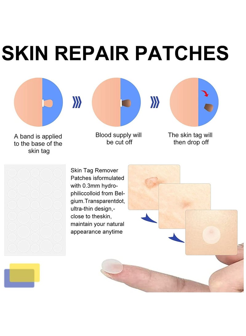 Skin Tag Removal Kit 2in1 Safe for Most Body Parts Painless Skin Tag Removal Kit for Small to Medium 5mm Skin Tags Includes Micro bands, Cleansing wipes & Repair patches Unisex