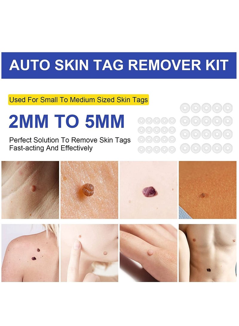 Skin Tag Removal Kit 2in1 Safe for Most Body Parts Painless Skin Tag Removal Kit for Small to Medium 5mm Skin Tags Includes Micro bands, Cleansing wipes & Repair patches Unisex