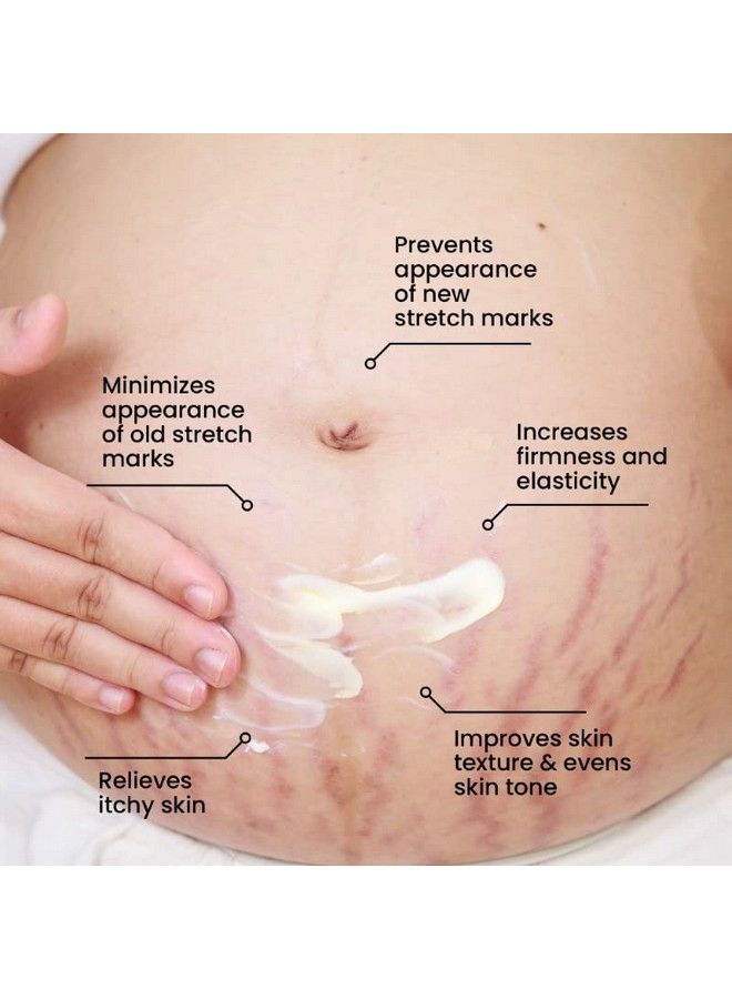 Stretch Marks Expert Serum Cream ; Combats And Improves Appearance Of New And Old Stretchmarks ; Powered By Striover Rosehip Oil And Squalane; Vegan And Crueltyfree ;30Ml